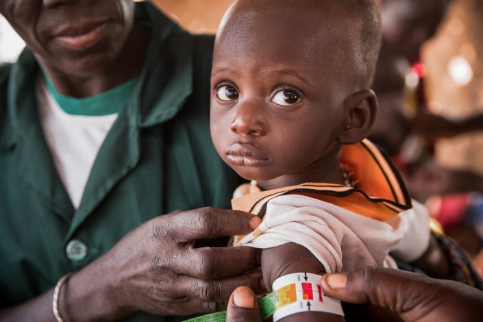 Badanie obwodu ramion u dzieci w Burkina Faso przez Caritas