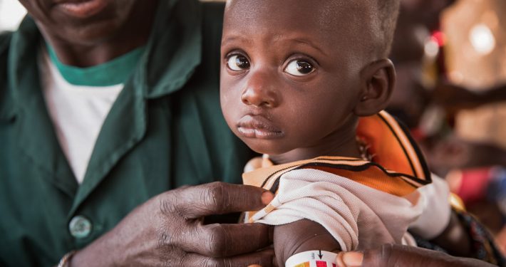 Badanie obwodu ramion u dzieci w Burkina Faso przez Caritas